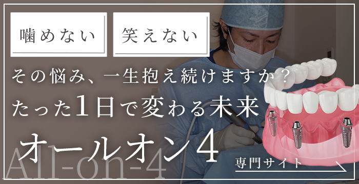 All-on-4（オールオンフォー）