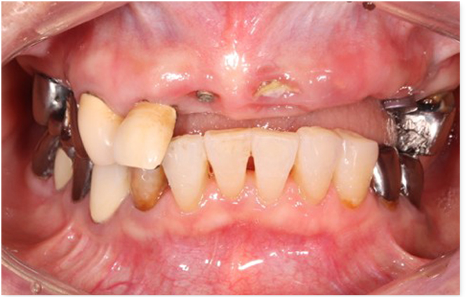 Before image