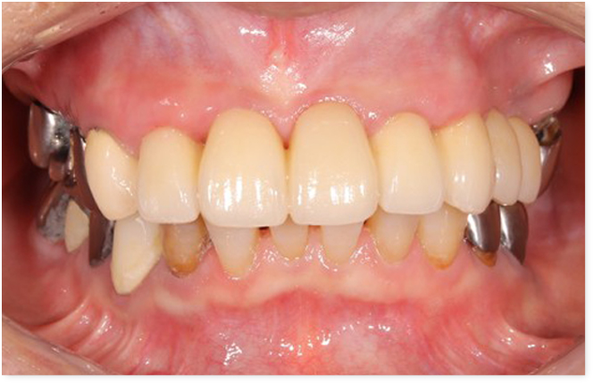 After image