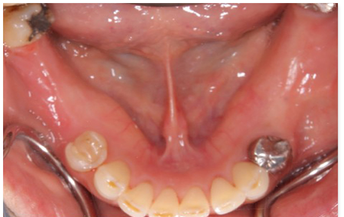 Before image