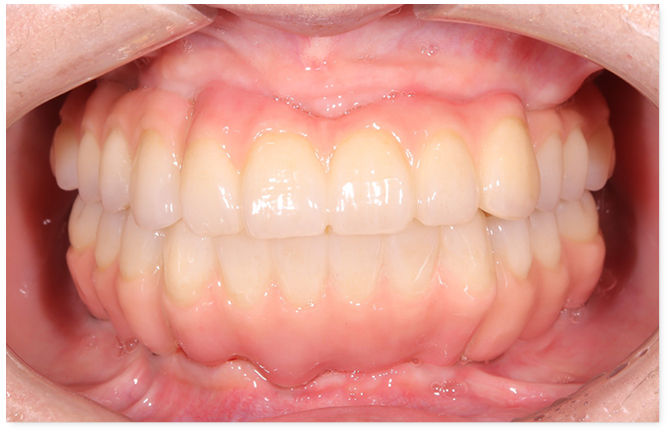 After image