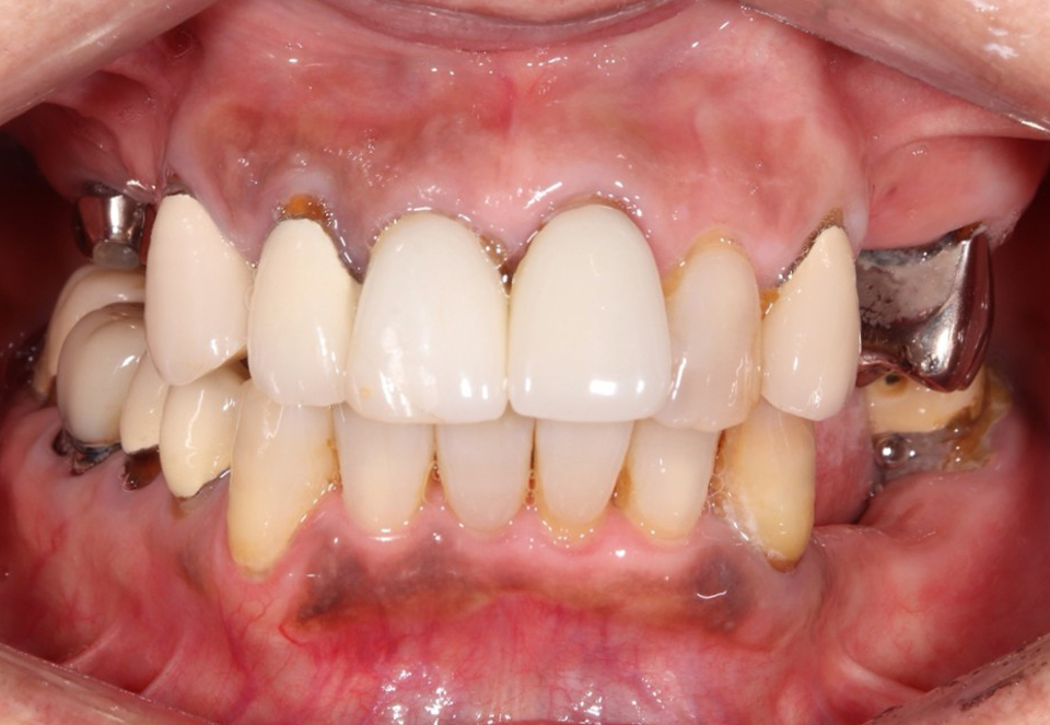 Before image