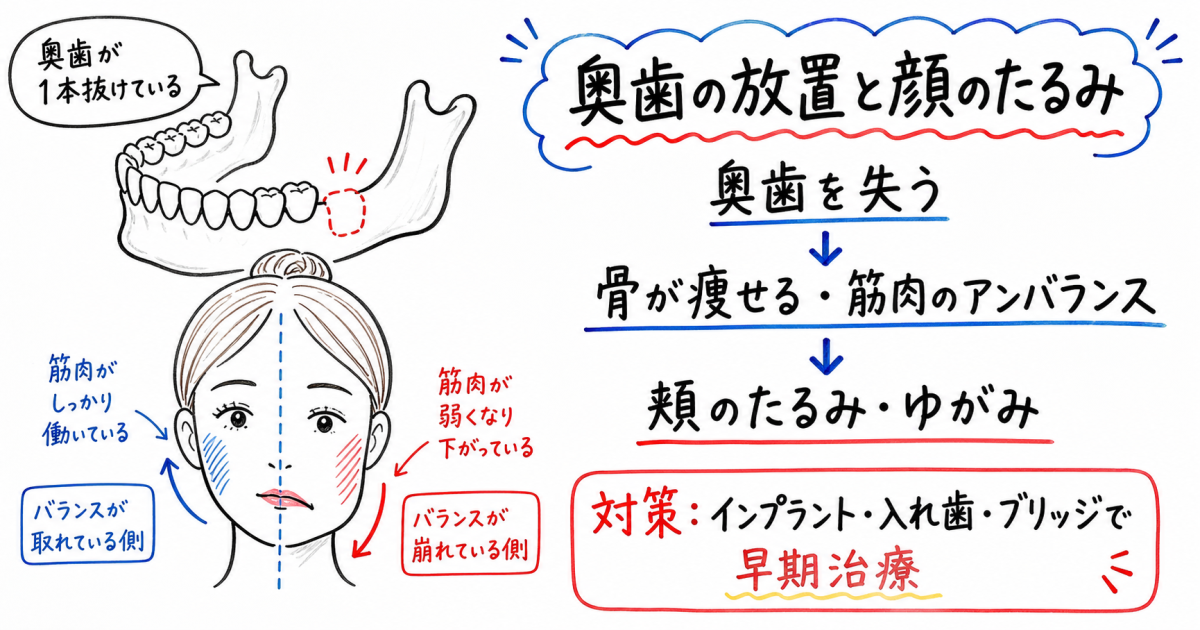 奥歯が抜けたまま放置すると老け顔に？顔のゆがみとたるみの関係性