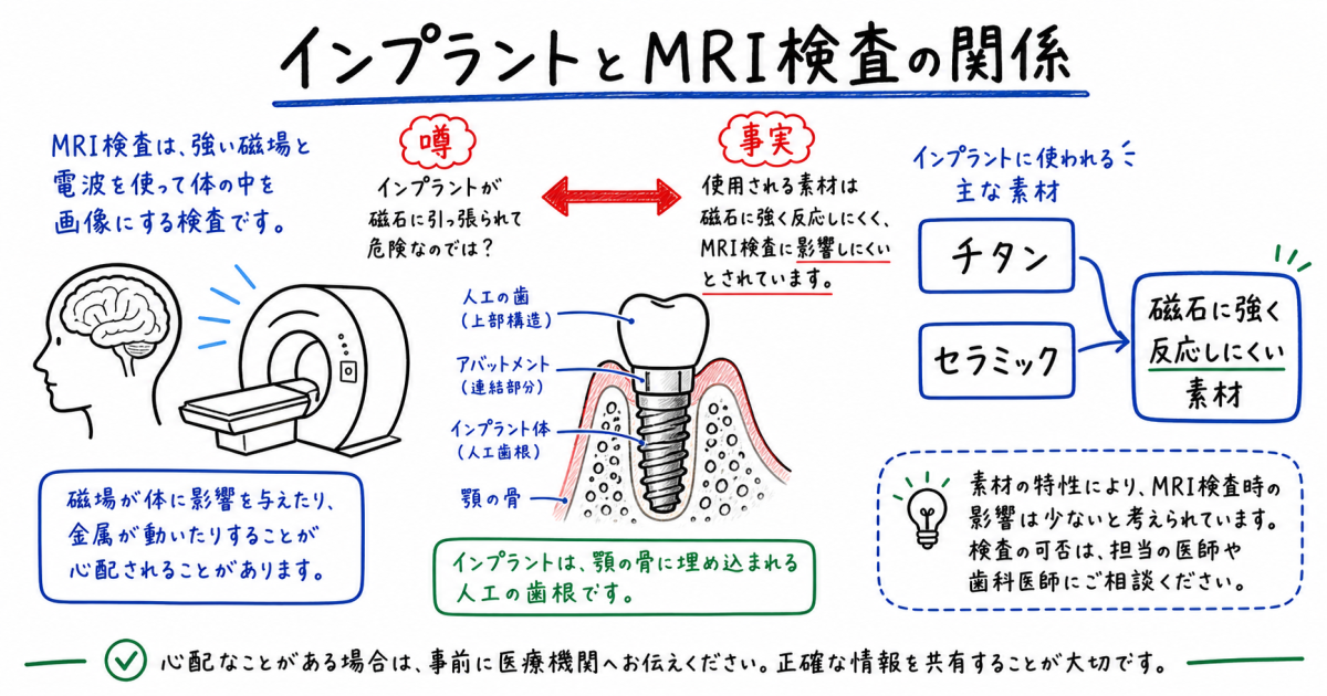 インプラントのMRIへの影響とは？噂の真偽を歯科医師が解説