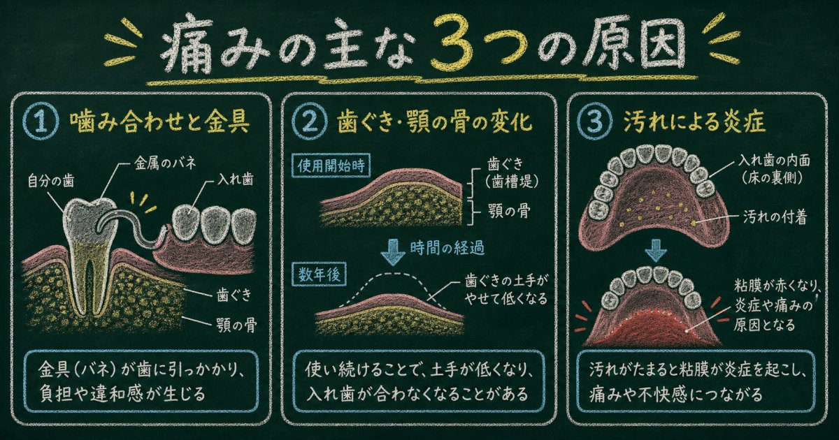 部分入れ歯が合わない・痛いと感じる主な原因