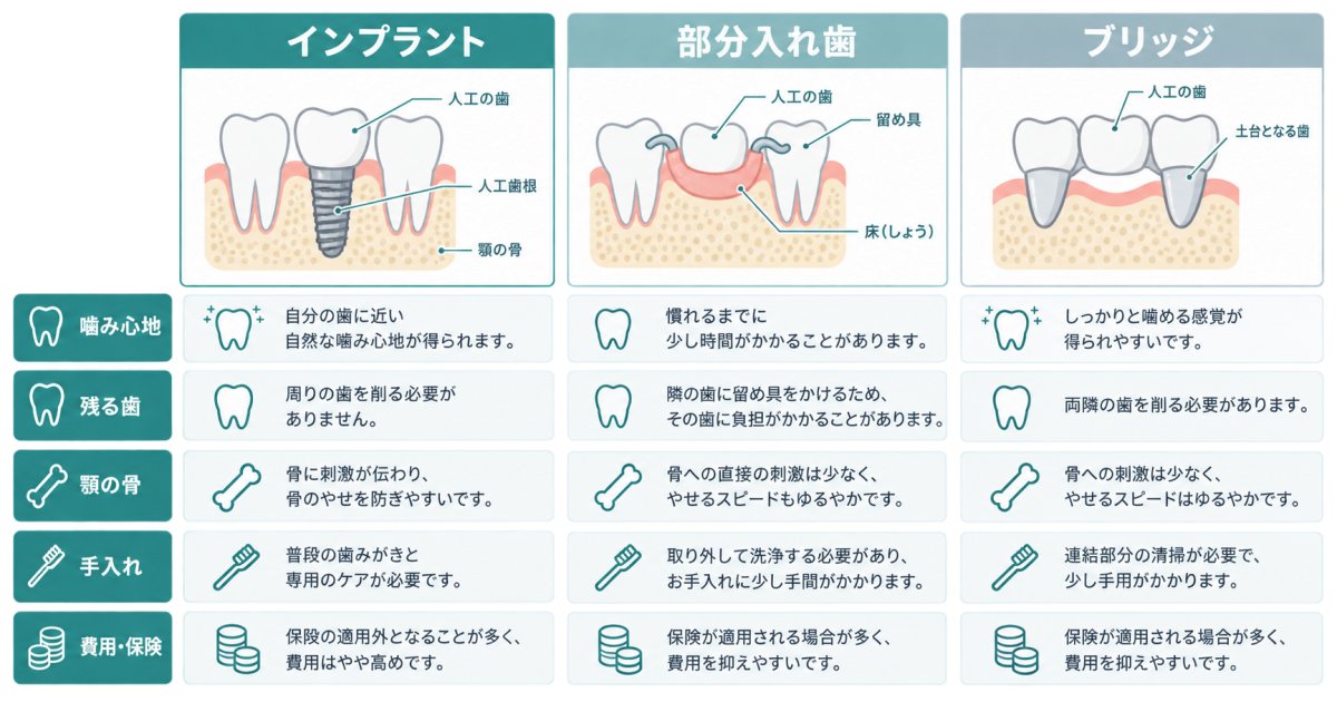 噛みやすさと残る歯への影響は、治療法でどう違う?