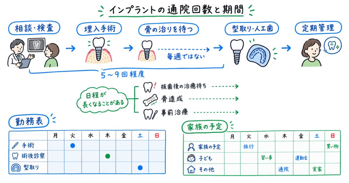 インプラントの通院回数と期間｜仕事や家族の予定と両立できる？